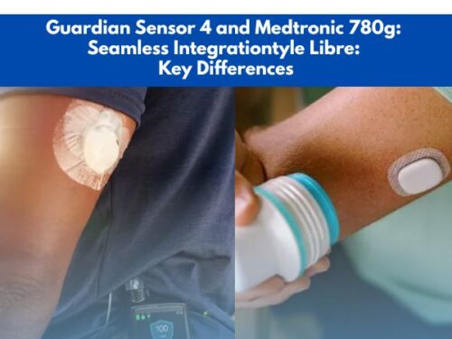 Guardian Sensor 4 and Medtronic 780g: Seamless Integration