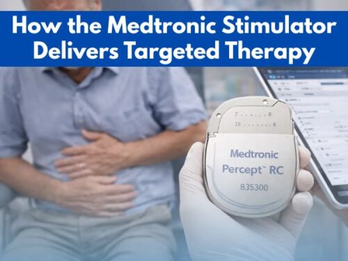 How the Medtronic Stimulator Delivers Targeted Therapy