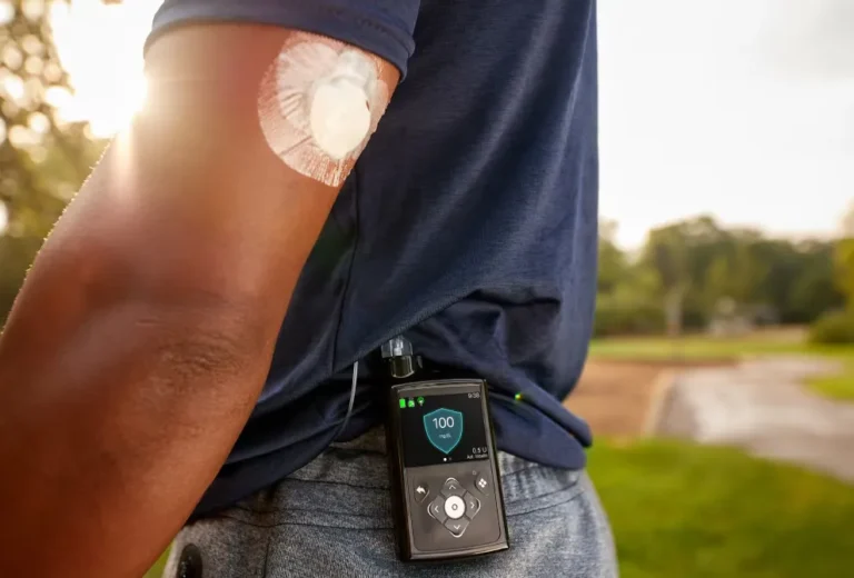 BGL data from CGM is directly sent to the Medtronic MiniMed pump