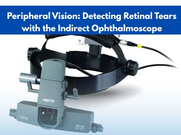 Peripheral Vision: Detecting Retinal Tears with the Indirect Ophthalmoscope