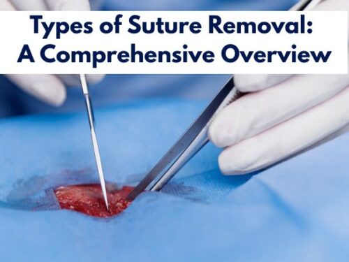 Types of Suture Removal: A Comprehensive Overview