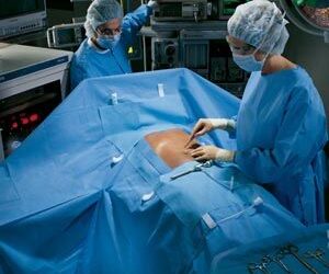 Laparoscope/ Cholecystectomy Pack II, Includes: (1) 104" x 76" x 120" Drape with Adjustable Fenestration, (1) Large Evolution Non-Reinforced Surgical Gown in Overwrap, (2) Large Evolution Non-Reinforced Gowns, (1) 44" x 90" Back Table Cover, Zone-Reinforced, (1) 23" x 54" Mayo Stand Cover, Reinforced, (10) 4" x 4" Sponges, X-Ray Detectable, and (1) Suture Bag, 5/cs