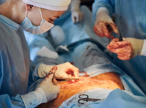 Stapling of surgical incisions also helps reduce blood loss