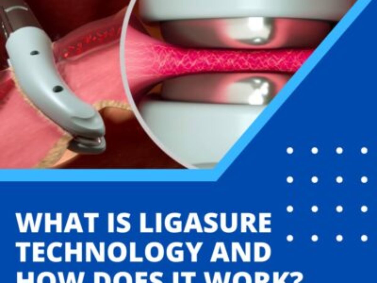 Small Jaw Instrument LigaSure™ 18.8 cm (7.4 Inch) - McKesson, image size:1200x900